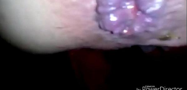  anal asshole fingering prolapse gape cumshot